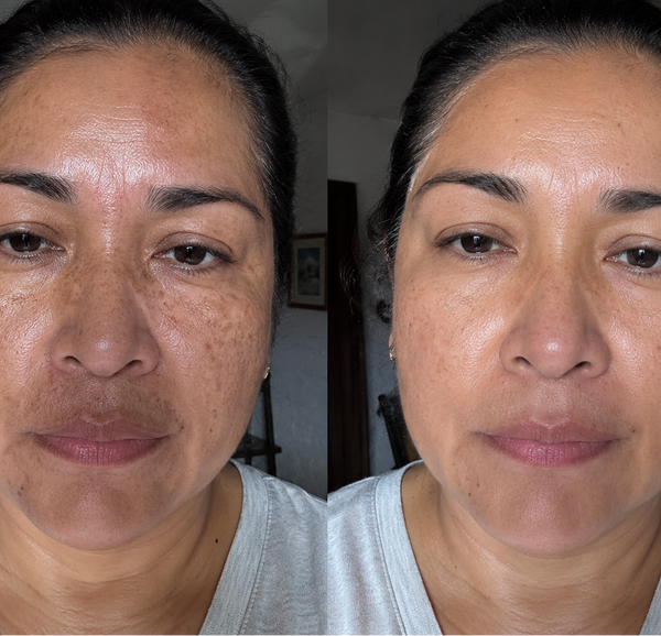 Diana C. · 43 años