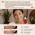 Hoygi Serum - Acné