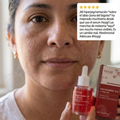 Hoygi Serum - Bigote