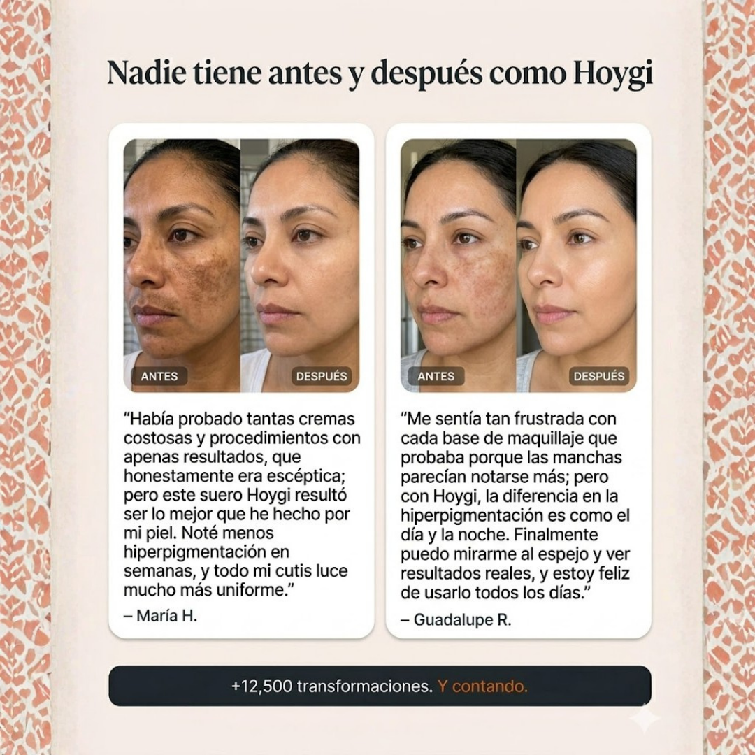 Hoygi Serum