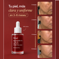 Hoygi Serum