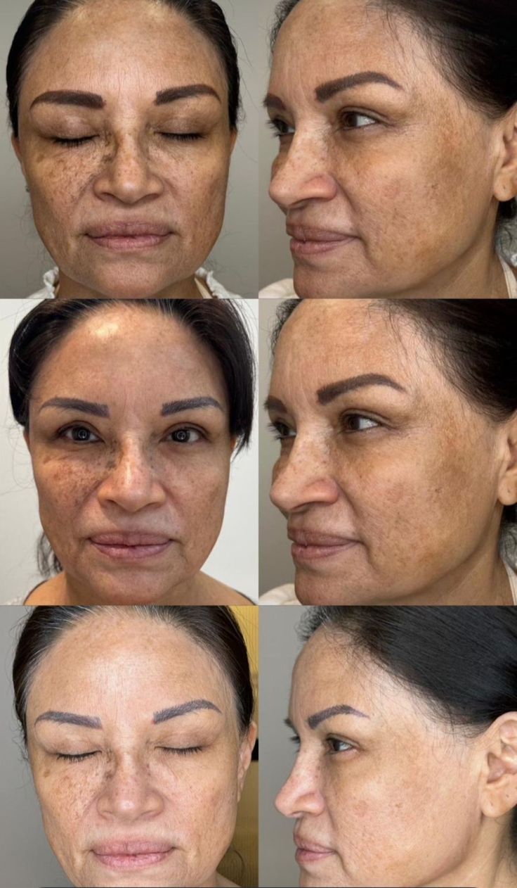 Hoygi Serum