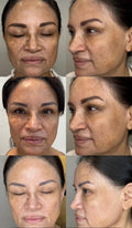 Hoygi Serum