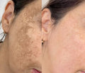 Hoygi Serum