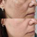 Hoygi Serum