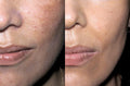 Hoygi Serum