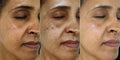 Hoygi Serum - Manchas edad