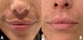 Hoygi Serum